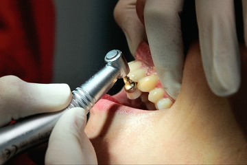 dentiste belfort