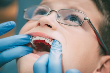 dentiste clermont-ferrand