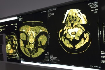 établissement de santé choisy-le-roi